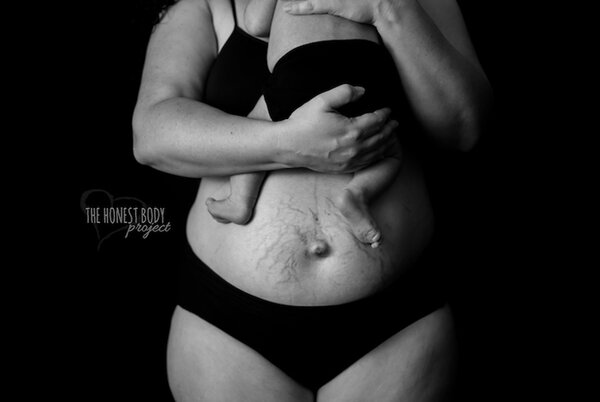 Тело после беременности
