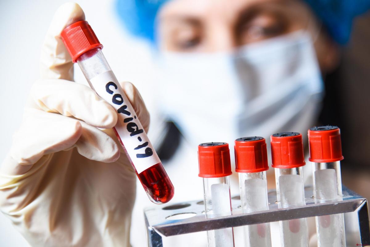 В Тульской области за сутки выявлено 266 случаев коронавируса
