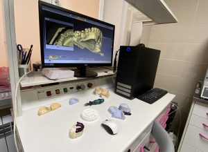 В тульской стоматологии появился новый 3D-принтер для создания протезов