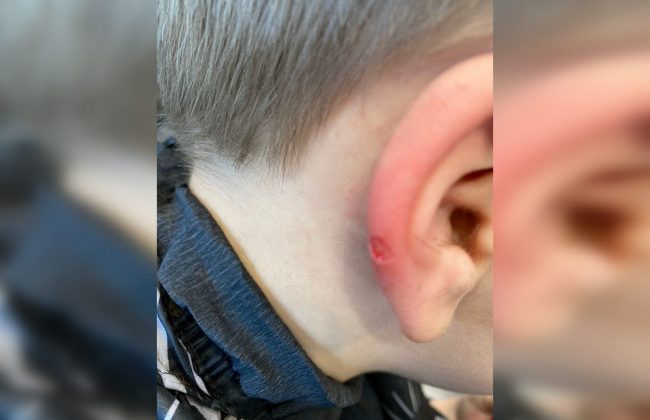 В Туле парикмахер отрезала маленькому ребенку часть уха во время стрижки